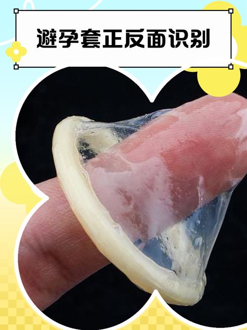 酒店的避孕套要钱吗